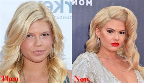 chanel west coast before and after surgery|is chanel west coast transformation.